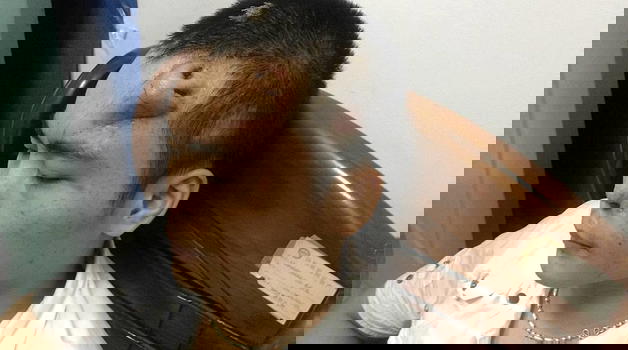 L’uomo con il naso sulla fronte (video)