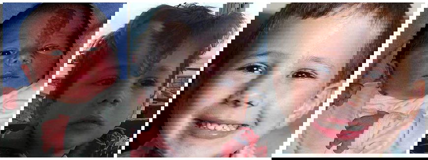 Il bambino con le corna per tornare normale