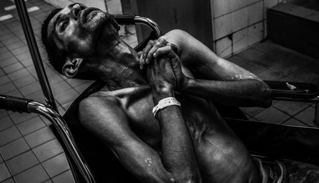 Morto di cancro in 39 giorni: il fratello racconta la storia in un reportage che sta facendo il giro del mondo