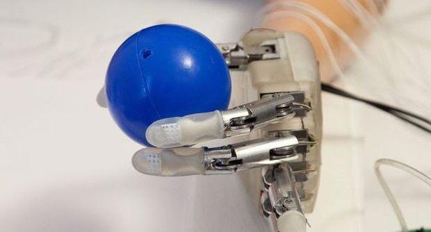 La mano bionica LifeHand impiantata ad un paziente al Gemelli di Roma