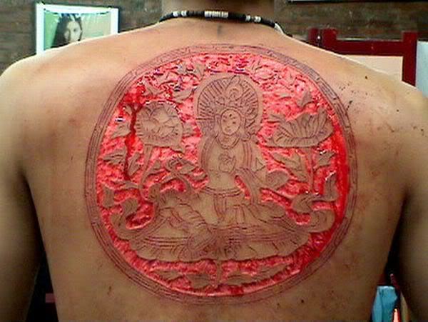 scarification