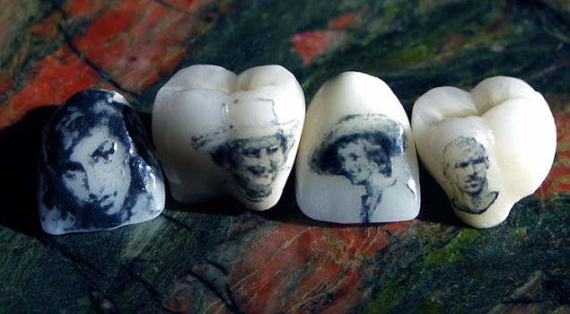 Tatuaggi sui denti, il nuovo sistema dall’Inghilterra