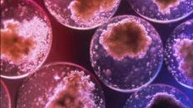 Tumori: scoperto lo starter che dà il via alle metastasi