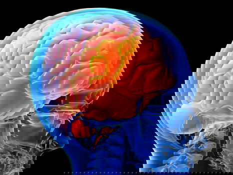 Germania: sviluppato un vaccino contro il tumore al cervello
