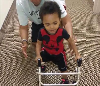 Bambino di 2 anni con una gamba amputata impara a camminare e commuove il mondo intero