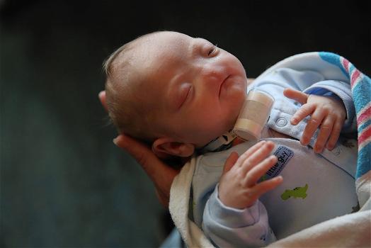 L’incredibile storia di un bambino nato senza naso e sistema olfattivo