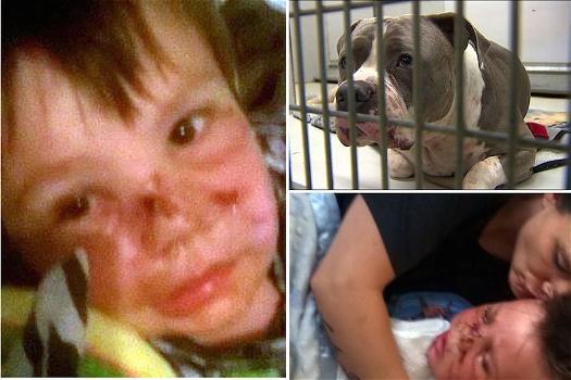 USA, bimbo di 4 anni sfigurato da un pit bull: “Mi ha mangiato”. E il cane verrà soppresso