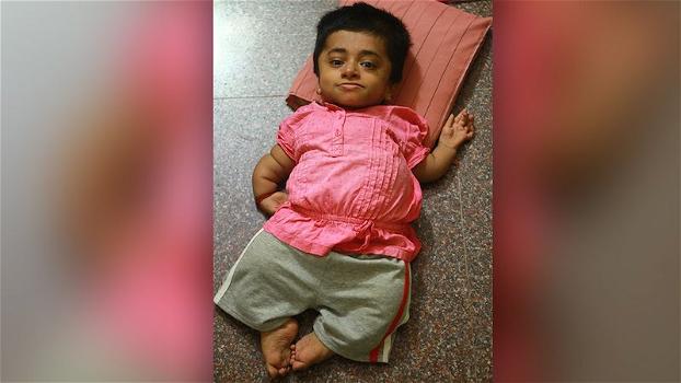 Storia di un’adulta chiusa nel corpo di una bambina: ecco il VIDEO di Girija Srinivas