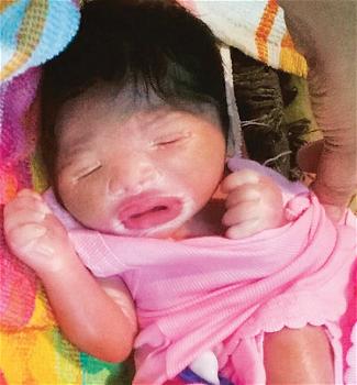 India, nasce la bambina di plastica: “Malattia rara”
