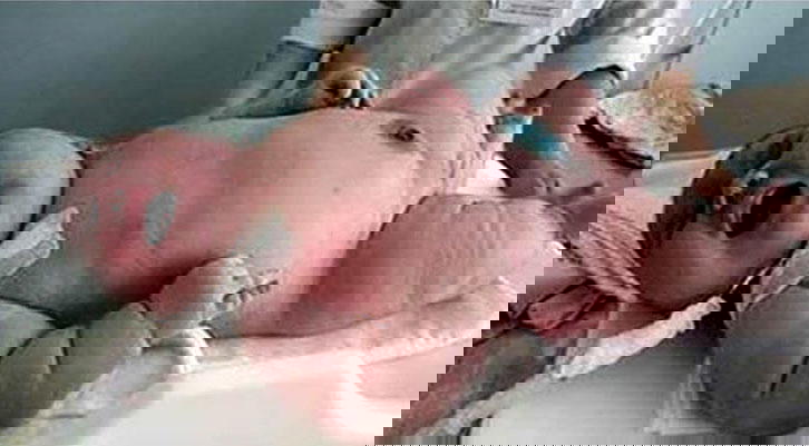 La bufala della donna di 272 kg che partorisce un bambino di 18 kg
