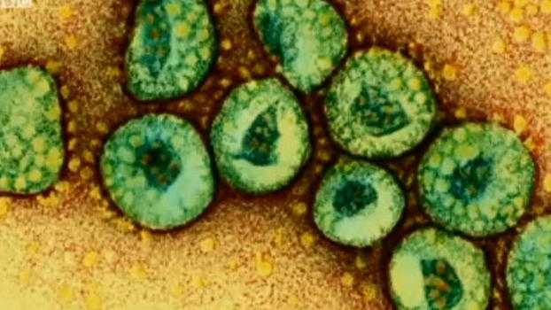 Virus Mers-Cov, ora è emergenza: muore quasi 1 su 2