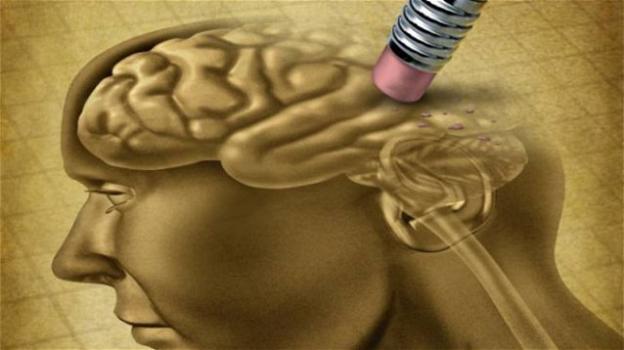 Alzheimer, arriva un nuovo farmaco che rallenta la malattia