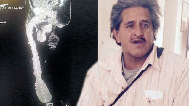 grande uomo del pene pene diviso