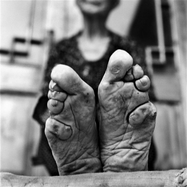12 foto delle ultime donne cinesi con i piedi fasciati
