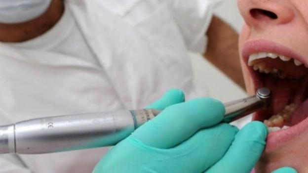 "Il dentista è troppo caro". Una persona su tre ci rinuncia