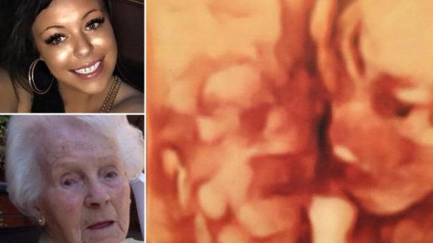Donna nota un particolare commovente nella sua ecografia
