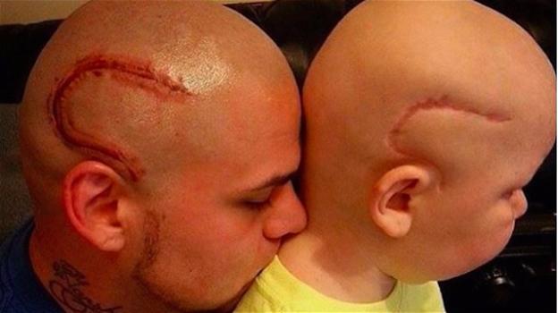 Padre si tatua la stessa cicatrice alla testa del figlio. Amore puro