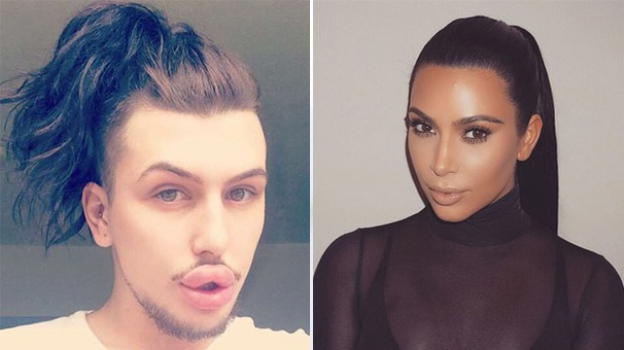 21.000 sterline spese per somigliare alle Kardashian. Ma è un ragazzo