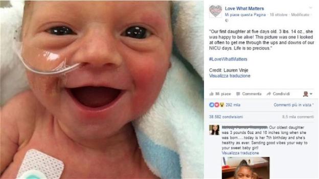 America, il sorriso di una bimba nata prematura conquista il web