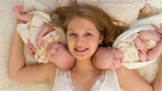 Rimane incinta mentre è già incinta: lo strano caso delle "gemelle non gemelle"