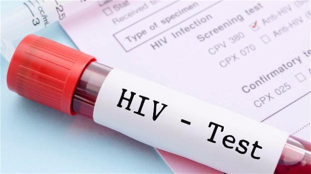Finalmente disponibile anche in Italia il test per l’autodiagnosi HIV