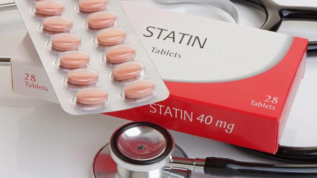 Assumere statine per ridurre il rischio di fibromi uterini