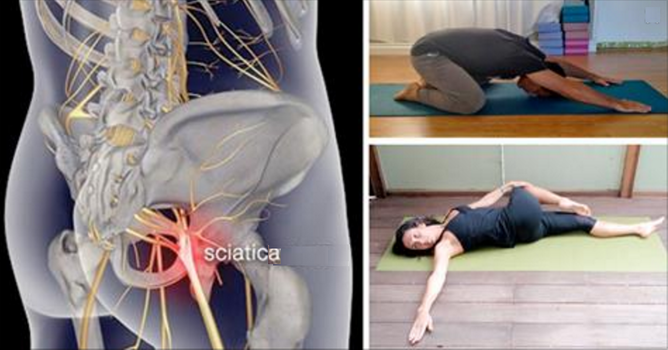 Questi semplici esercizi di yoga allevieranno il dolore al nervo sciatico in 16 minuti