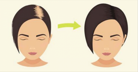 Lo shampoo col bicarbonato spopola: i risultati sono eccezionali, guardate qui!