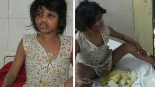 India Trovata In Una Foresta Una Bambina Allevata Dalle Scimmie