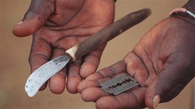 Nel mondo 200 milioni di donne sono vittime di mutilazioni genitali