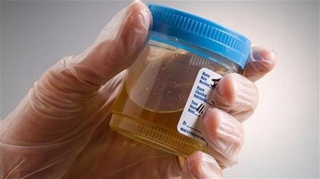 Batteriuria: batteri nelle urine, sintomi e infezione asintomatica