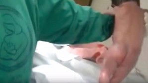 Brasile, neonata muove i primi passi appena nata