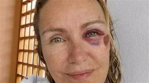 Licia Colò viva per miracolo: "Ho rischiato di rompermi la testa"