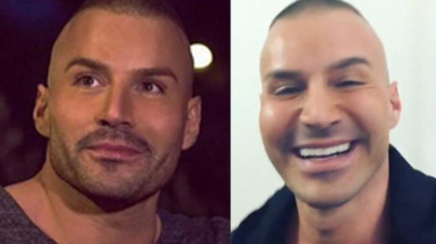 Jack Vanore di U&D accusato di ritocchi al viso. La sua dura reazione