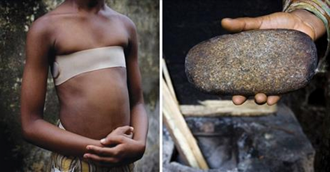 Lo fanno alle ragazzine con le pietre: l’ennesima pratica brutale made in Africa