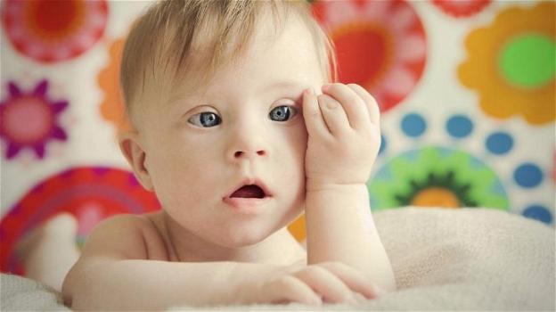 In Islanda non nascono più bambini con la sindrome di Down