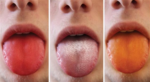 Il colore della lingua rivela la condizione di salute del nostro corpo