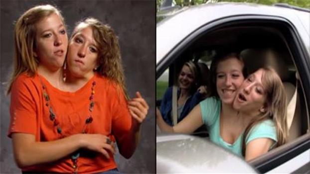 Due gemelle siamesi spiegano come riescono a guidare un’auto