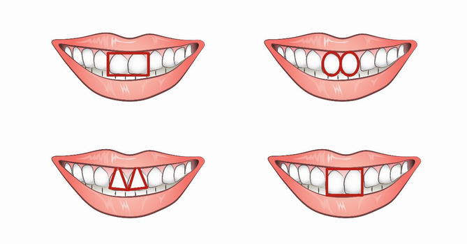 Scopri che personalità hai dalla forma dei tuoi denti!