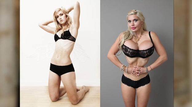 Pixee Fox, "La Barbie umana": quanto ha speso e come era prima