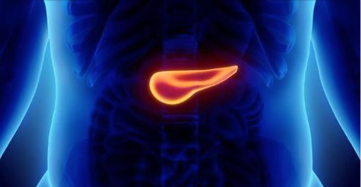 Tumore Al Pancreas Come Si Muore