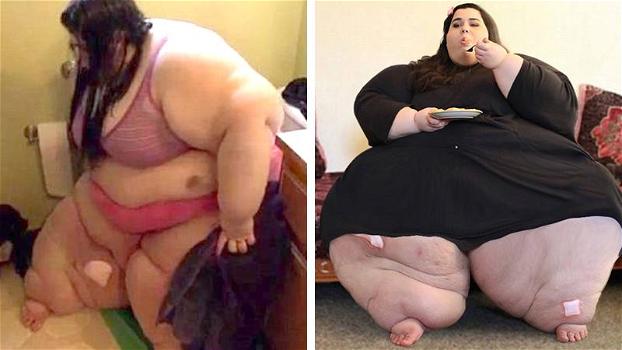 Questa ragazza perde 300 kg ed il suo fidanzato resta basito. Ecco come è diventata