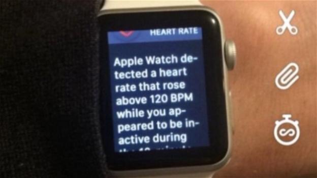 USA, Apple Watch avvisa i suoi utenti: la partita di football li sta emozionando troppo