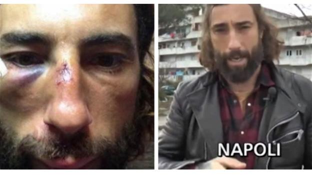 Striscia la Notizia, Vittorio Brumotti aggredito a Napoli: lanciate pietre e uova