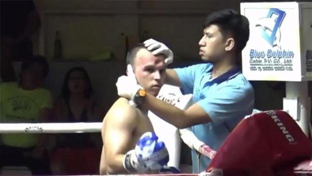 Riceve una gomitata in fronte sul ring: il lottatore non si accorge di avere il cranio sfondato