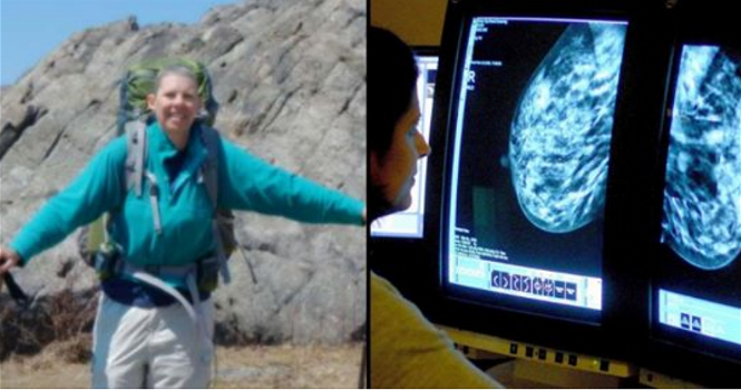 Una speranza contro il cancro: donna con cancro terminale al seno curata con l’immunoterapia