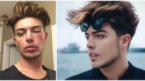 Stash, leader dei The Kolors, torna a parlare dell’aggressione con particolari agghiaccianti: “Nessuno interveniva”