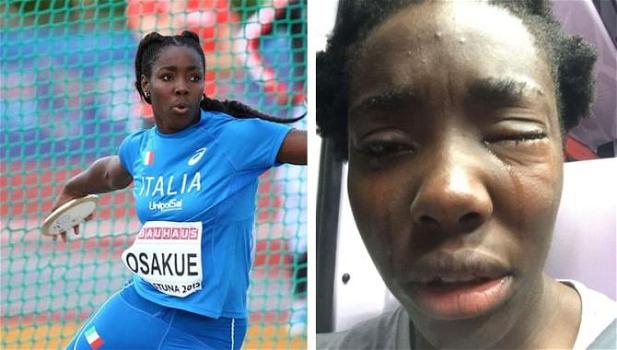 L’atleta italiana Daisy Osakue aggredita nella notte a Torino. Il PD: “Colpa di Salvini”