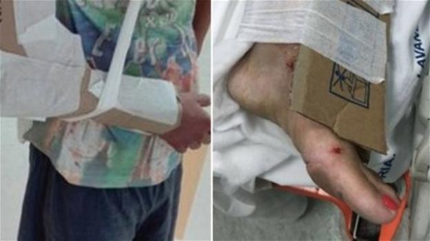 Reggio Calabria, pronto soccorso ortopedico: per le fratture il cartone al posto dei gessi