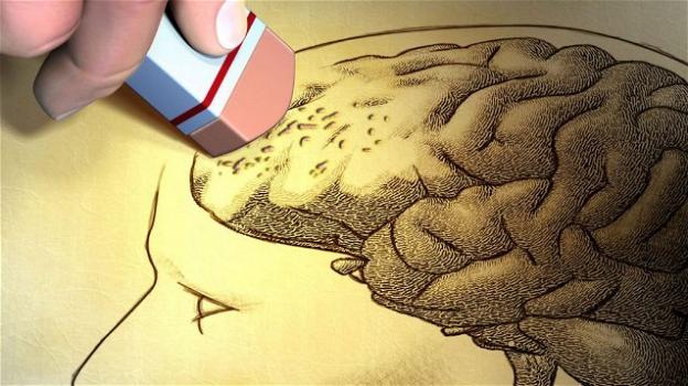 Alzheimer: un farmaco potrebbe prevenirlo